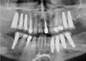 dental-5-dental-xray